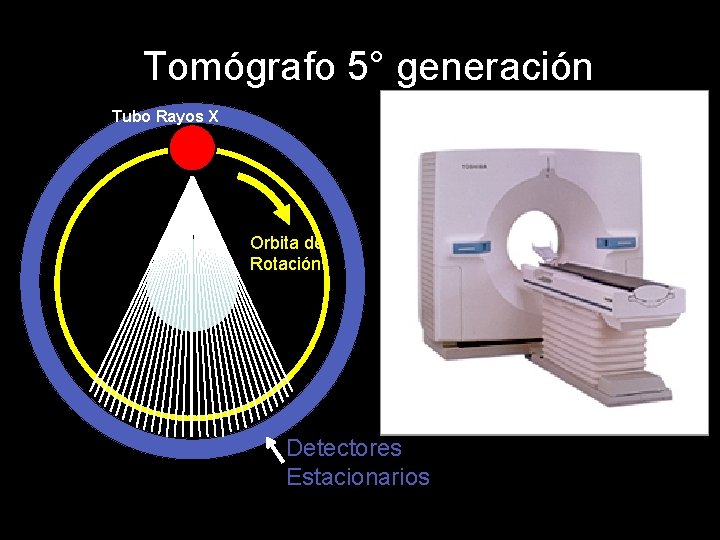 Tomógrafo 5° generación Tubo Rayos X Orbita de Rotación Detectores Estacionarios 