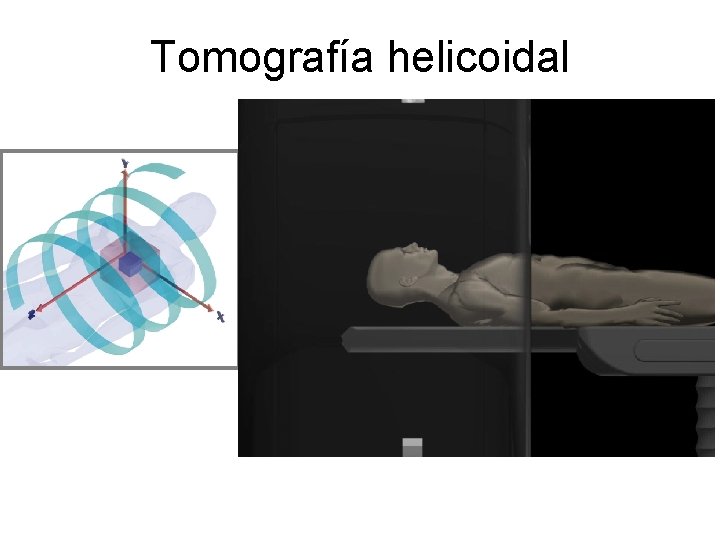 Tomografía helicoidal 