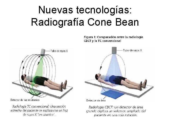 Nuevas tecnologías: Radiografía Cone Bean 