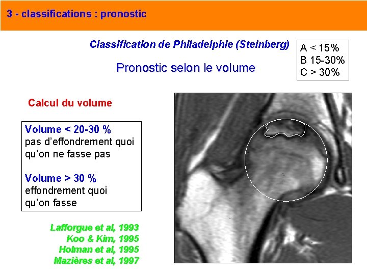 3 - classifications : pronostic Classification de Philadelphie (Steinberg) Pronostic selon le volume Calcul