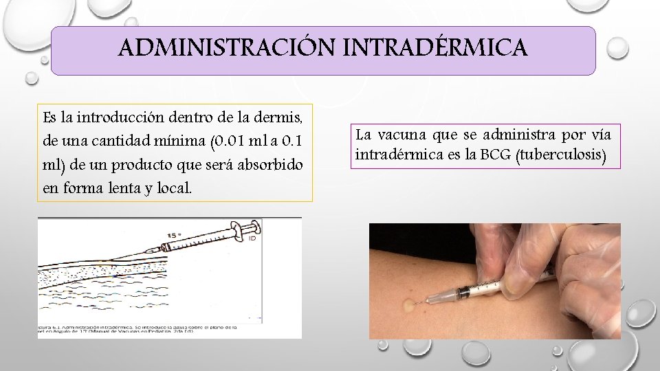 ADMINISTRACIÓN INTRADÉRMICA Es la introducción dentro de la dermis, de una cantidad mínima (0. ADMINISTRACIÓN INTRADÉRMICA Es la introducción dentro de la dermis, de una cantidad mínima (0.