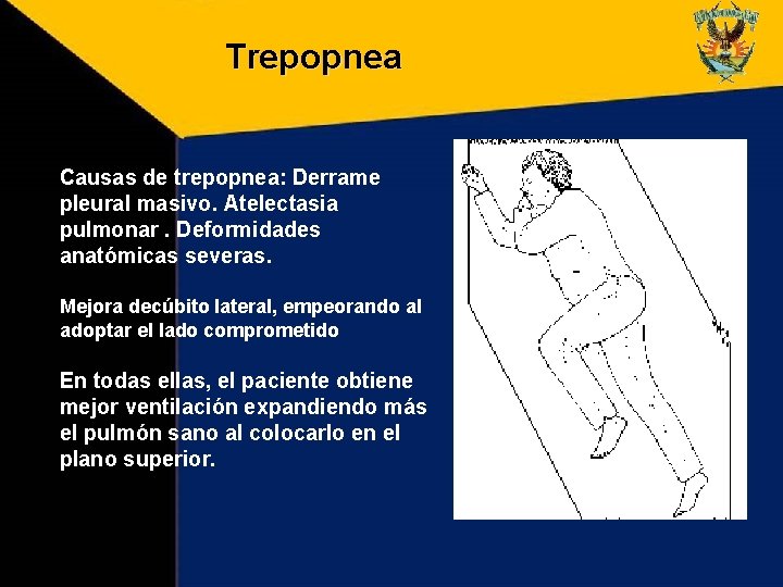 Trepopnea Causas de trepopnea: Derrame pleural masivo. Atelectasia pulmonar. Deformidades anatómicas severas. Mejora decúbito