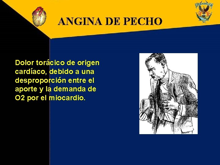 ANGINA DE PECHO Dolor torácico de origen cardíaco, debido a una desproporción entre el