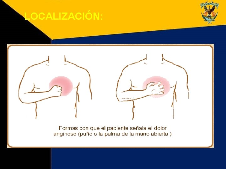 LOCALIZACIÓN: 