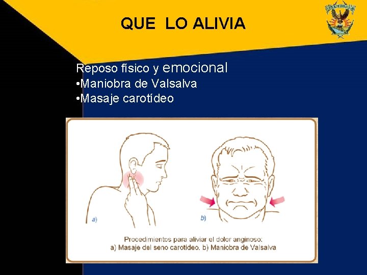 QUE LO ALIVIA Reposo físico y emocional • Maniobra de Valsalva • Masaje carotídeo QUE LO ALIVIA Reposo físico y emocional • Maniobra de Valsalva • Masaje carotídeo