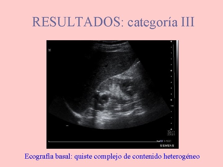 RESULTADOS: categoría III Ecografía basal: quiste complejo de contenido heterogéneo 