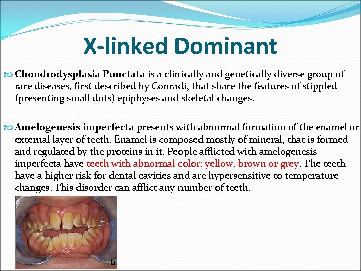 X-linked Dominant Chondrodysplasia Punctata is a clinically and genetically diverse group of rare diseases, X-linked Dominant Chondrodysplasia Punctata is a clinically and genetically diverse group of rare diseases,