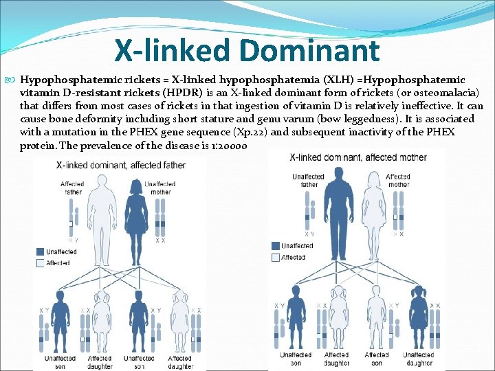 X-linked Dominant Hypophosphatemic rickets = X-linked hypophosphatemia (XLH) =Hypophosphatemic vitamin D-resistant rickets (HPDR) is X-linked Dominant Hypophosphatemic rickets = X-linked hypophosphatemia (XLH) =Hypophosphatemic vitamin D-resistant rickets (HPDR) is