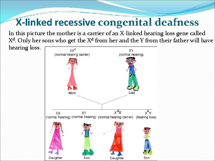 X-linked recessive congenital deafness In this picture the mother is a carrier of an X-linked recessive congenital deafness In this picture the mother is a carrier of an
