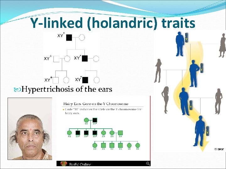 Y-linked (holandric) traits Hypertrichosis of the ears Y-linked (holandric) traits Hypertrichosis of the ears