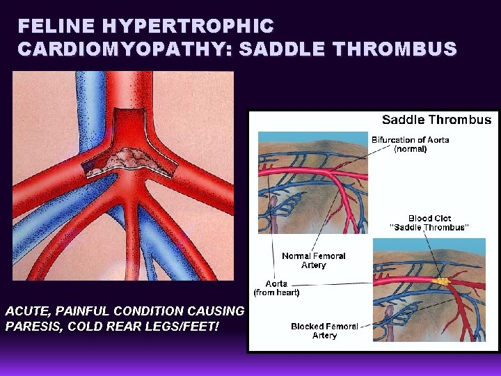 FELINE HYPERTROPHIC CARDIOMYOPATHY: SADDLE THROMBUS ACUTE, PAINFUL CONDITION CAUSING PARESIS, COLD REAR LEGS/FEET! 