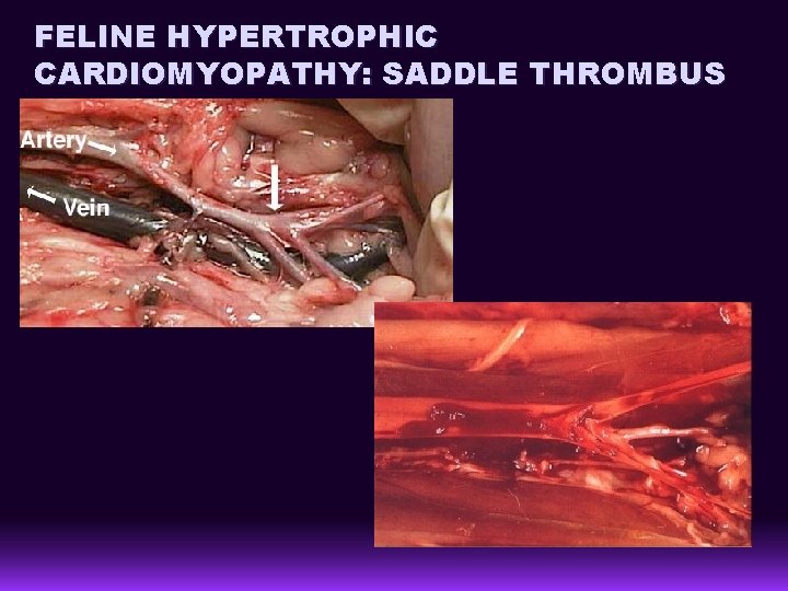 FELINE HYPERTROPHIC CARDIOMYOPATHY: SADDLE THROMBUS 