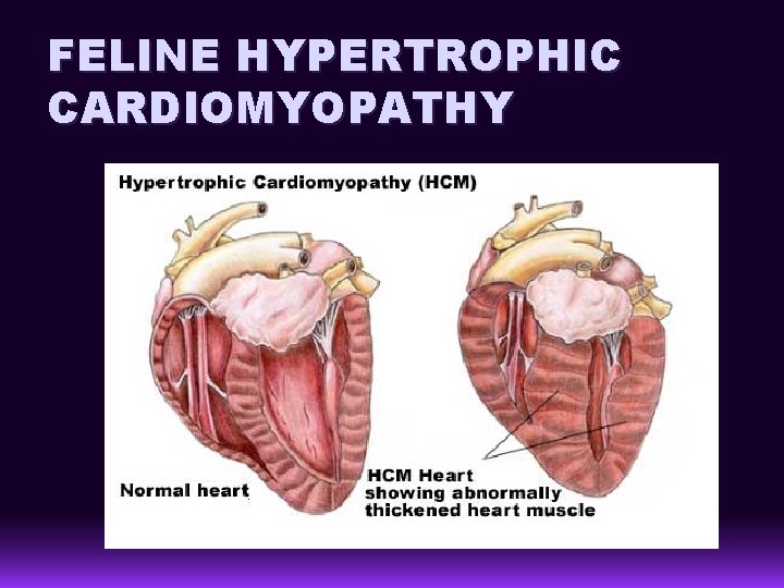 FELINE HYPERTROPHIC CARDIOMYOPATHY 