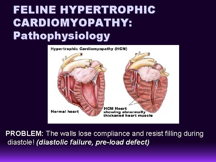 FELINE HYPERTROPHIC CARDIOMYOPATHY: Pathophysiology PROBLEM: The walls lose compliance and resist filling during diastole!