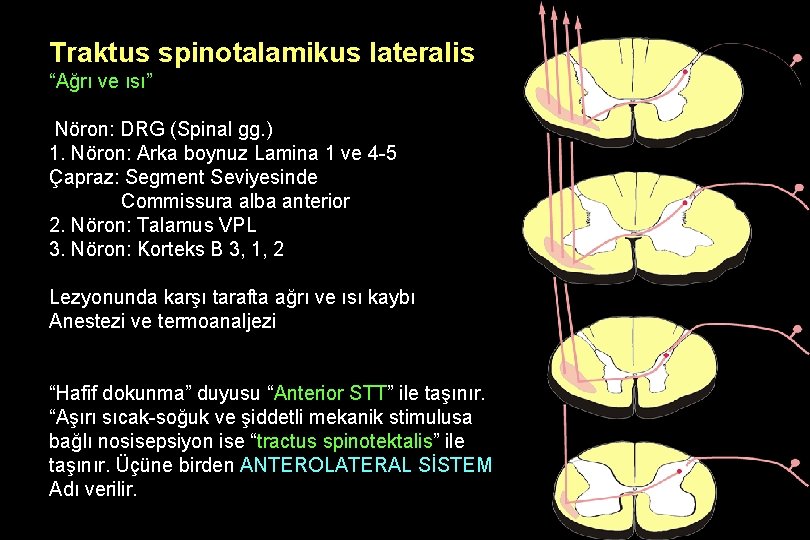 Traktus spinotalamikus lateralis “Ağrı ve ısı” Nöron: DRG (Spinal gg. ) 1. Nöron: Arka