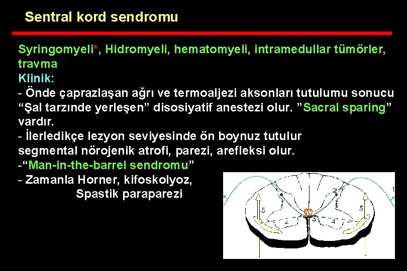 Sentral kord sendromu Syringomyeli*, Hidromyeli, hematomyeli, intramedullar tümörler, travma Klinik: - Önde çaprazlaşan ağrı