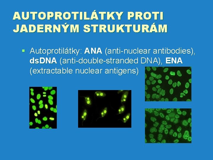 AUTOPROTILÁTKY PROTI JADERNÝM STRUKTURÁM § Autoprotilátky: ANA (anti-nuclear antibodies), ds. DNA (anti-double-stranded DNA), ENA