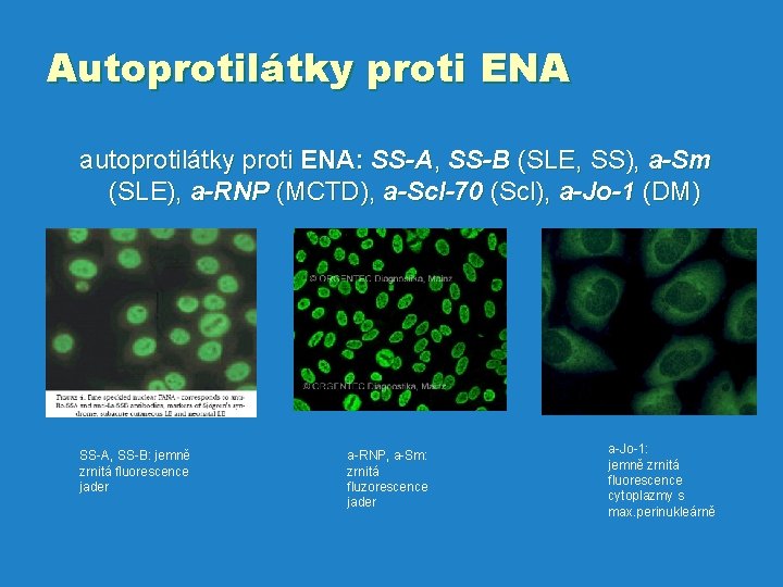 Autoprotilátky proti ENA autoprotilátky proti ENA: SS-A, SS-B (SLE, SS), a-Sm (SLE), a-RNP (MCTD),