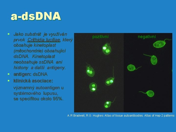 a-ds. DNA § Jako substrát je využíván pozitivní prvok Crithidia luciliae, který obsahuje kinetoplast