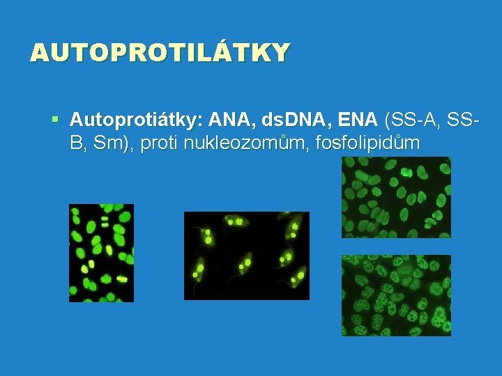 AUTOPROTILÁTKY § Autoprotiátky: ANA, ds. DNA, ENA (SS-A, SSB, Sm), proti nukleozomům, fosfolipidům 