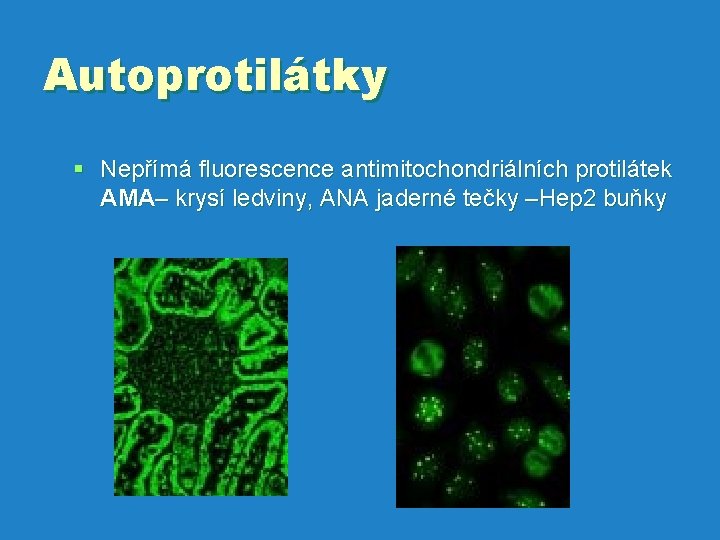 Autoprotilátky § Nepřímá fluorescence antimitochondriálních protilátek AMA– krysí ledviny, ANA jaderné tečky –Hep 2