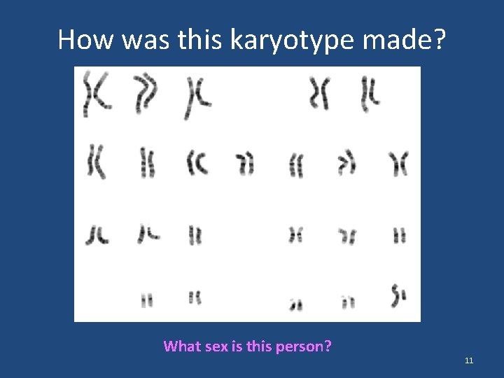 How was this karyotype made? What sex is this person? 11 