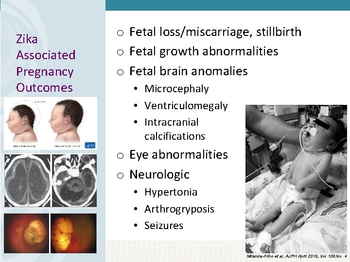 Zika Associated Pregnancy Outcomes o Fetal loss/miscarriage, stillbirth o Fetal growth abnormalities o Fetal