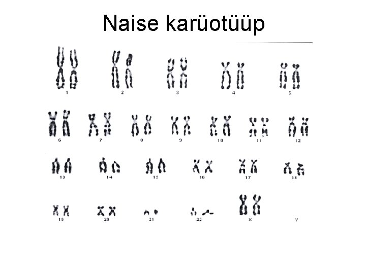 Naise karüotüüp 
