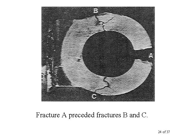 Fracture A preceded fractures B and C. 24 of 37 