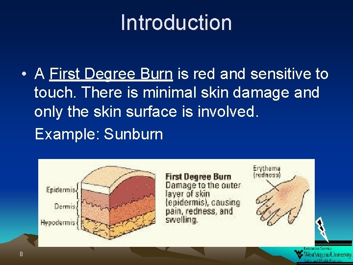 Introduction • A First Degree Burn is red and sensitive to touch. There is