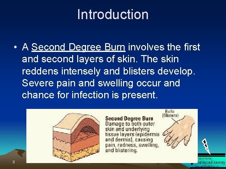 Introduction • A Second Degree Burn involves the first and second layers of skin.