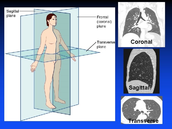 Coronal Sagittal Transverse Coronal Sagittal Transverse