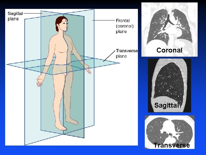 Coronal Sagittal Transverse 