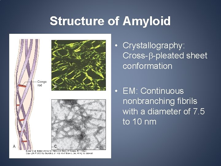 Structure of Amyloid • Crystallography: Cross- -pleated sheet conformation • EM: Continuous nonbranching fibrils Structure of Amyloid • Crystallography: Cross- -pleated sheet conformation • EM: Continuous nonbranching fibrils