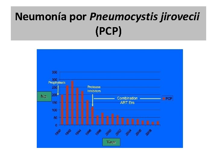 Neumonía por Pneumocystis jirovecii (PCP) Neumonía por Pneumocystis jirovecii (PCP)