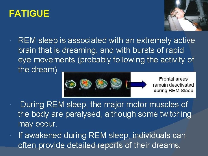 FATIGUE REM sleep is associated with an extremely active brain that is dreaming, and