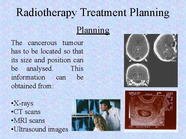 Radiotherapy Treatment Planning The cancerous tumour has to be located so that its size