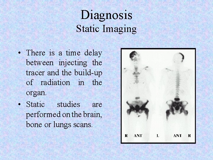 Diagnosis Static Imaging • There is a time delay between injecting the tracer and
