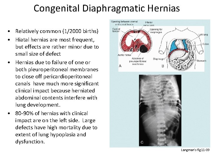 Congenital Diaphragmatic Hernias • Relatively common (1/2000 births) • Hiatal hernias are most frequent,