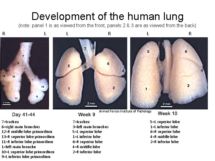 Development of the human lung (note: panel 1 is as viewed from the front,