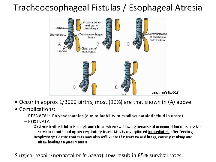 Tracheoesophageal Fistulas / Esophageal Atresia Langman’s fig 6 -18 • Occur in approx 1/3000
