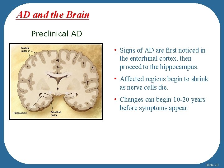 AD and the Brain Preclinical AD • Signs of AD are first noticed in