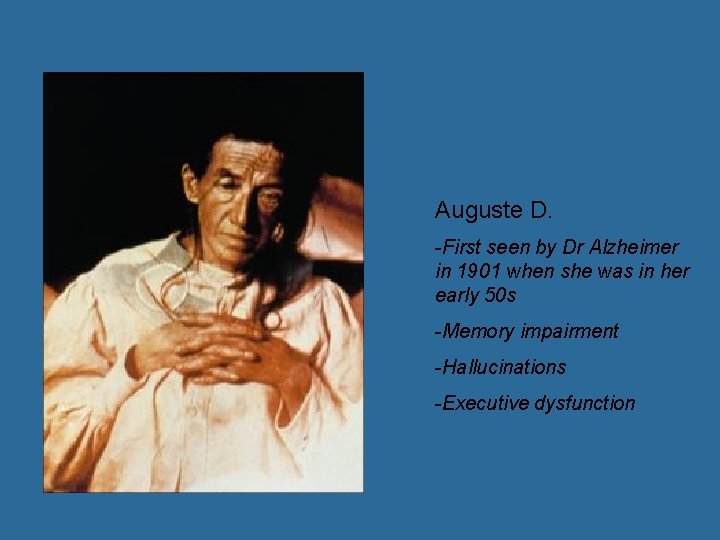 Auguste D. -First seen by Dr Alzheimer in 1901 when she was in her