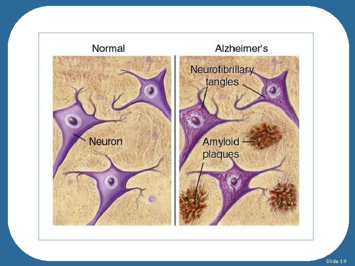 Slide 19 