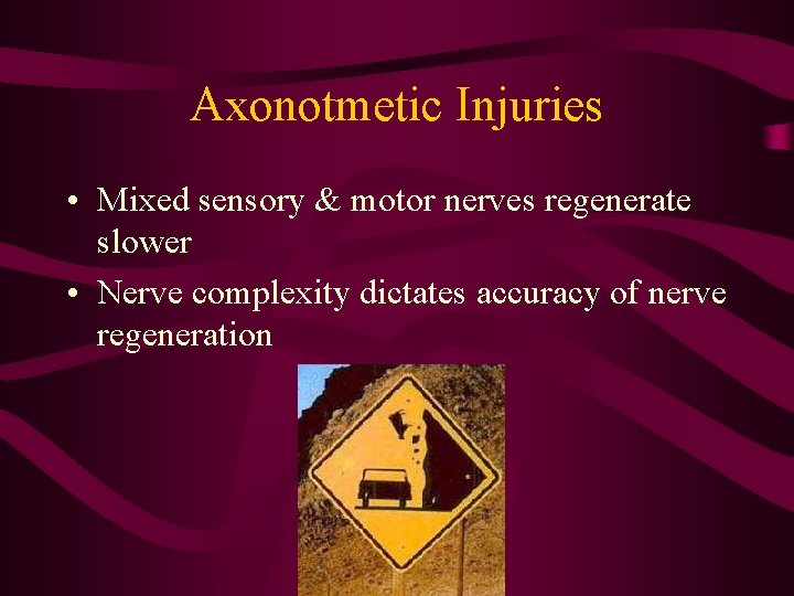 Axonotmetic Injuries • Mixed sensory & motor nerves regenerate slower • Nerve complexity dictates
