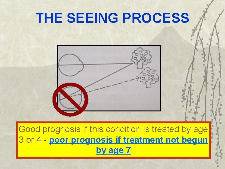 THE SEEING PROCESS Good prognosis if this condition is treated by age 3 or