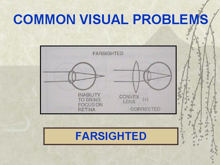 COMMON VISUAL PROBLEMS FARSIGHTED 