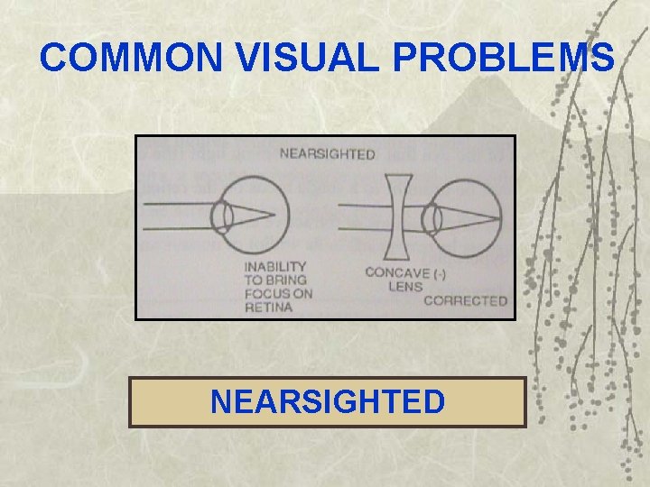 COMMON VISUAL PROBLEMS NEARSIGHTED 