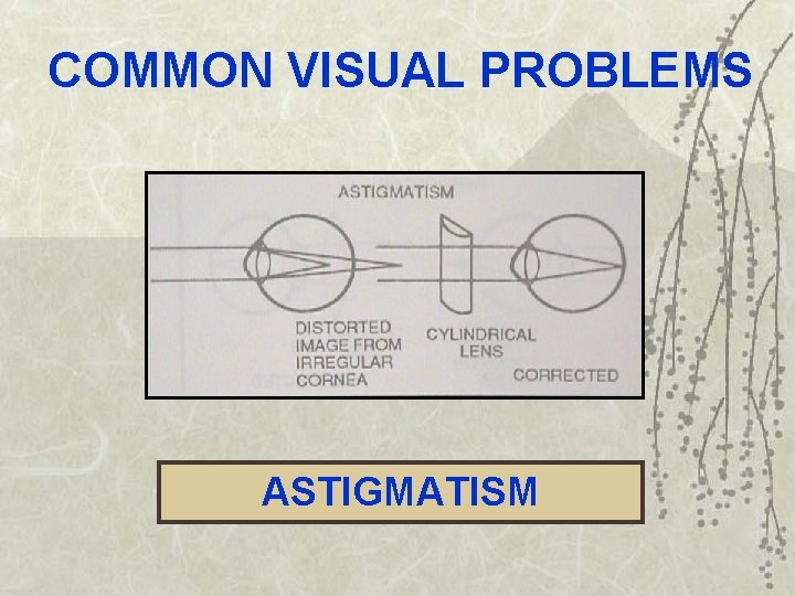 COMMON VISUAL PROBLEMS ASTIGMATISM 