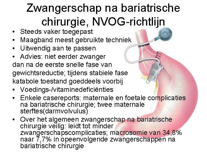 Zwangerschap na bariatrische chirurgie, NVOG-richtlijn • Steeds vaker toegepast • Maagband meest gebruikte techniek